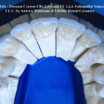 gallery-1a-250