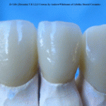 gallery-1c-250