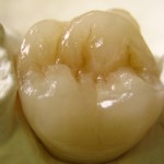 gallery3-450