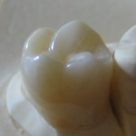 opalite 002 final-450