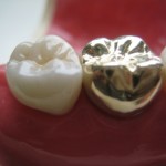 opalite gold1-450
